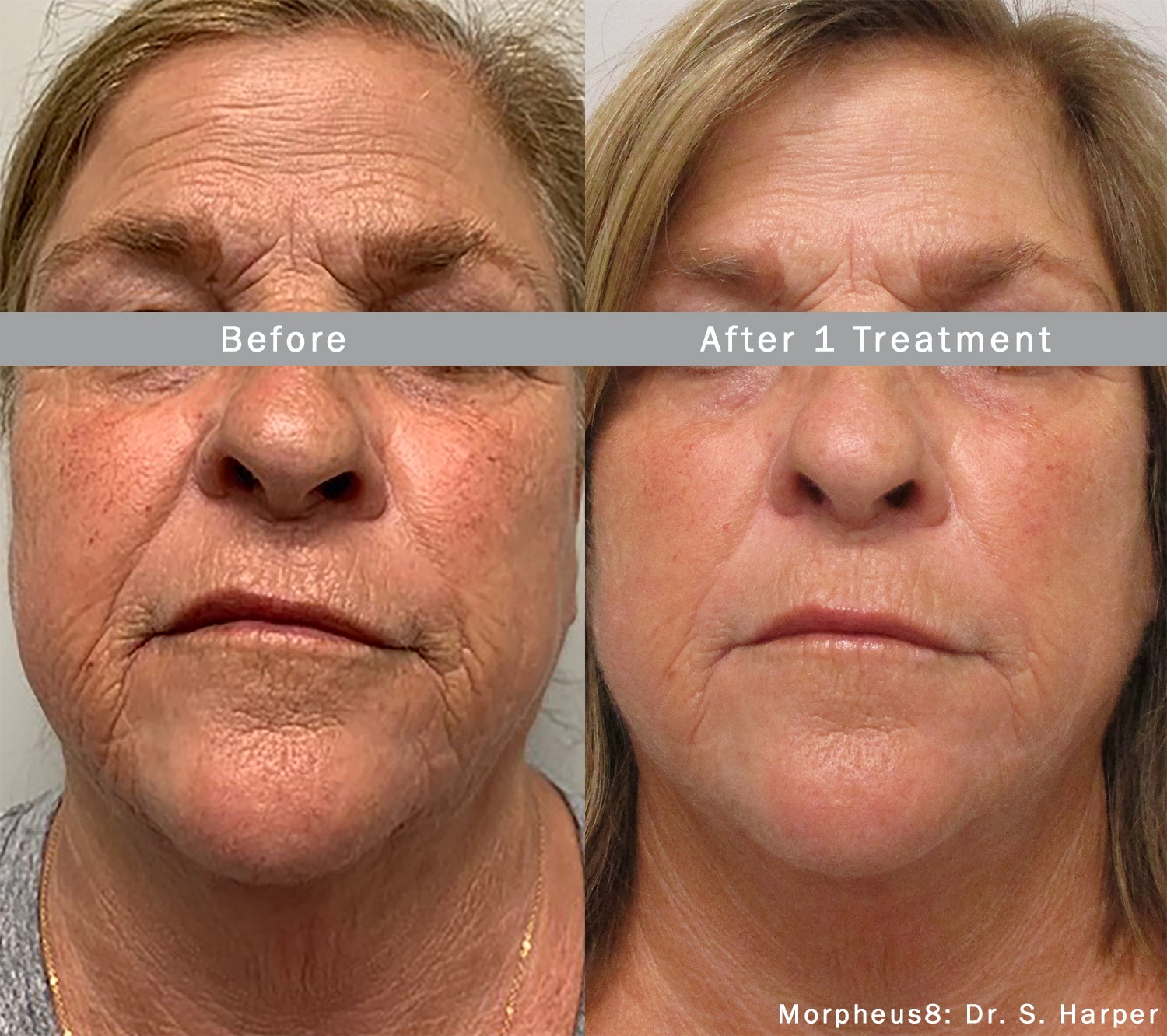 Medspa Services in Waldorf, MD | Radiant Aesthetic and Wellness